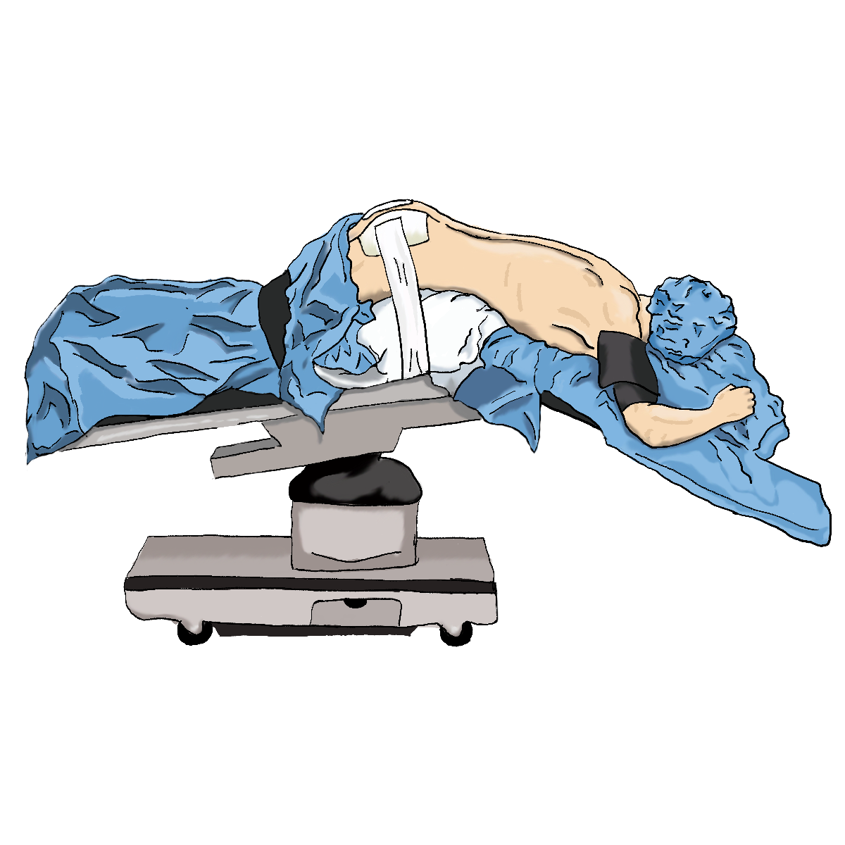 Safely & effectively position patients for any hospital procedure.